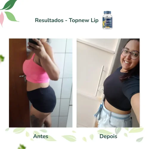 Antes e Depois Topnew Lip - Topnew Suplementos 1