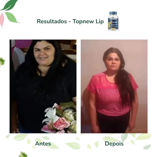 Antes e Depois Topnew Lip - Topnew Suplementos 1