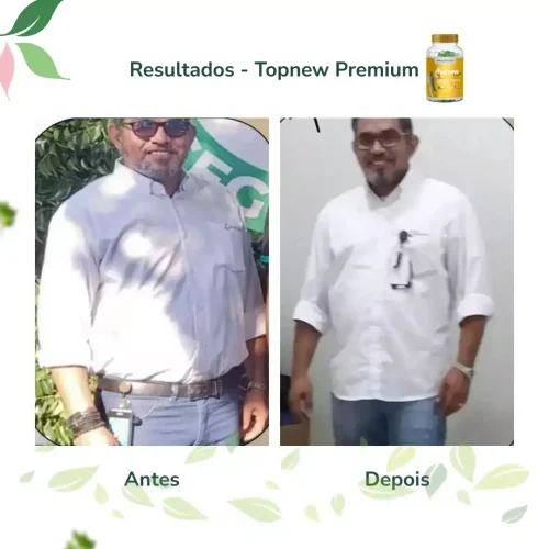 Antes e Depois Topnew Premium - Topnew Suplementos 12