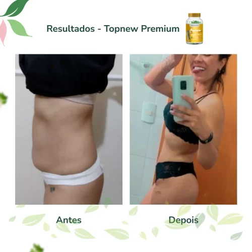 Antes e Depois Topnew Premium - Topnew Suplementos 7