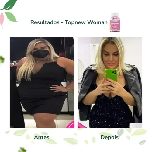 Antes e Depois Topnew Woman - Topnew Suplementos 1