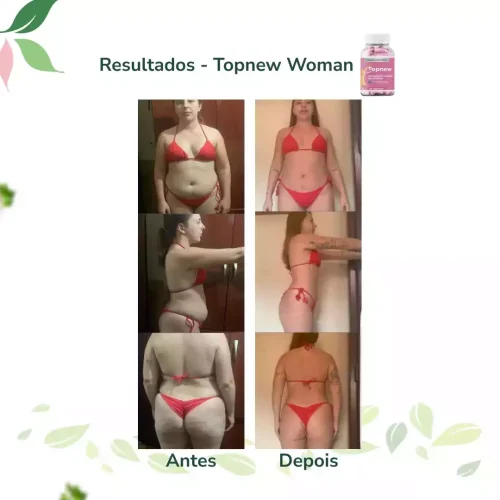 Antes e Depois Topnew Woman - Topnew Suplementos 3