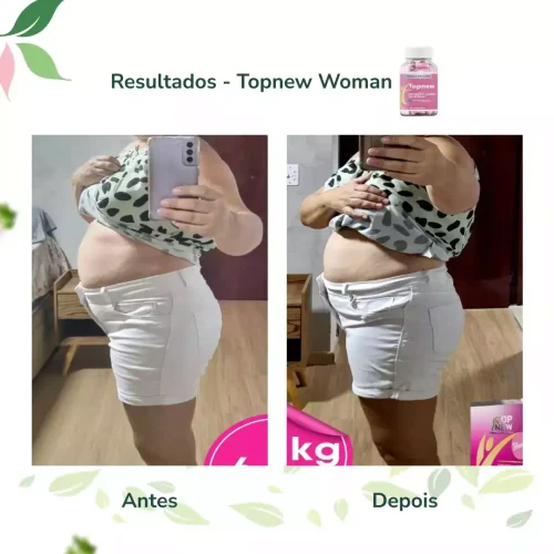 Antes e Depois Topnew Woman - Topnew Suplementos 6