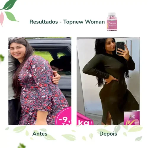 Antes e Depois Topnew Woman - Topnew Suplementos 7